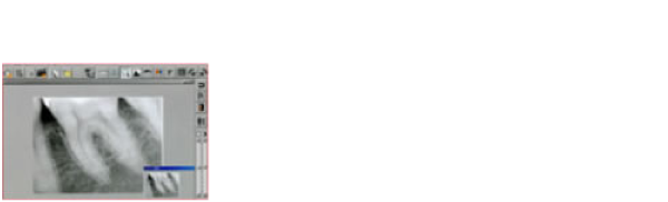 デジタルX線　撮影後、すぐにモニター上で写真の確認、診断ができます。放射線量も従来の半分以下です。