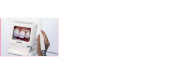 口腔内カメラ　奥歯や歯の裏側の虫歯などを確認していただくときに使います。